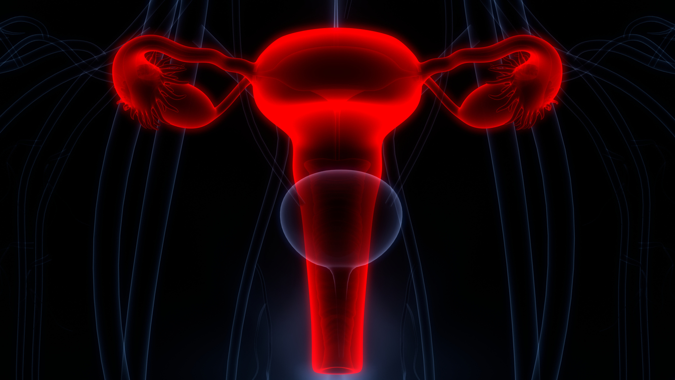 How to Reduce Cervical Cancer Deaths in Africa: Essential Preventive Measures